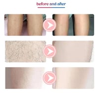 جهاز ليزر منزلي لازالة الشعر بشكل دائم