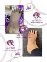 خلطة ود للتصبغات