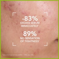 منظف ​​بيوديرما سيبيوم المنقي للبشرة الدهنية - 200...