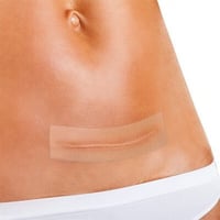 لصقات السليكون لعلاج الندبات Deramed