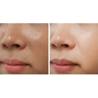 ايه سي ام - ديب وايت ادفانسيد كريم مزيل للبقع والت...