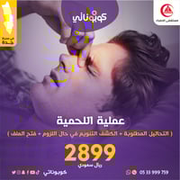 عملية إزالة اللحمية مع التحاليل المطلوبة الى عمر 1...