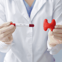 تحليل الغدة الدرقية TSH - مختبرات مستشفى الحمراء -...