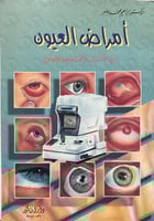 امراض العيون بين الاسباب والتشخيص والعلاج