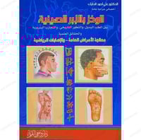 الوخز بالابر الصينية