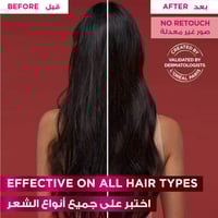 الفيف شامبو ضد تساقط الشعر بالبروتين 600 مل