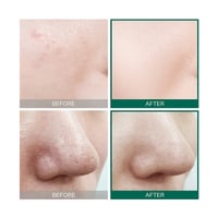 تونر المعجزة AHA BHA PHA من سوم باي مي 150مل - Som...