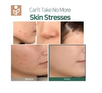 زيت الشاي المعجزة من سوم باي مي 10 مل - some by me...