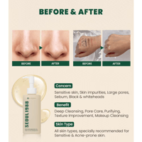 غسول زيتي سيول 1988 بصنوبر سيكا 1% + بروبيوتيك من...