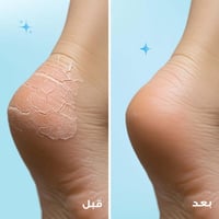 كي بي بلس كريم مرطب البشرة 75 مل