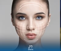 إبرة الریتش 10 مل