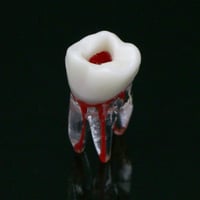 Molar 3 canals
