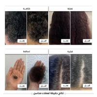 محاسن زيت الشعر كثافة و تحفيز و نمو الشعر وإطالته