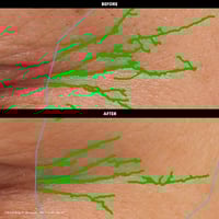 سيفورا كريم تهدئة وشد بشرة العين تنعيم و شد - 20 م...