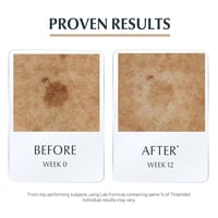 يوسيرين سيروم مضاد للشيخوخه هيالورون فيلر 30 مل