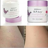 ديرما دكتور مقشر الجسم كي بي ديوتي - 473 مل