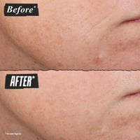 كيلز مجموعه العنايه بالبشره ميني