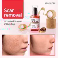 سوم باي مي سيروم الحلزون الأسود لإصلاح البشرة - 50...