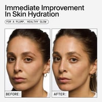 يوث تو ذا بيبول كريم مرطب حمض الهيالورونيك - 7.4 م...