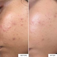 رين كلين سكين كير ايه اتش ايه تونر لتفتيح البشرة ج...