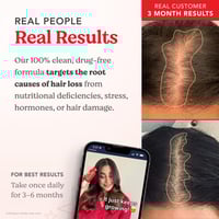 هيرتامين فيتامين للنمو الشعر - 30 كبسولة