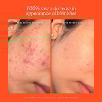 تاور 28 طقم ميني اس او اس للعناية بالبشرة 3 قطع