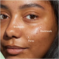 كودالي فينو بيور محلول ساليسيليك لعلاج البقع 15 مل...