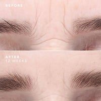 سيروم التجاعيد و مكافحة الشيخوخة و العناية بالبشرة...