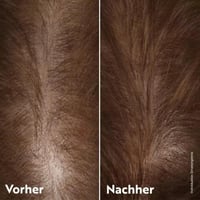 اهوهو مجموعة العناية تكثيف ومنع تساقط الشعر 3 قطع