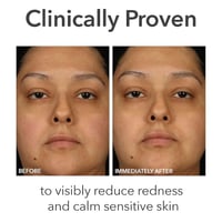 دكتور دينيس جروس كريم الفا بيتا للبشره 7 مل ميني