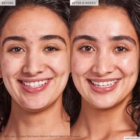 جلو ريسيبي سيروم بلاك بيري ريتينول 5 مل ميني