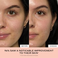 اولي هنريكسن سيروم نياسيناميد بفيتامين سي نكهه الخ...