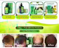 جرين ويلث لوشن نيو هير لوشن علاج جذور الشعر - 120...