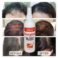 هوب لابز انرجايزر منشط لبصيلات الشعر مع زيت الجوجو...