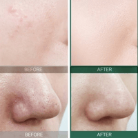 سوم باي مي كريم ميراكل 30 يوم المعزز بالأحماض - 60...