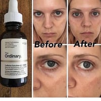 ذا اوردنري محلول الكافيين 5% اي جي سي جي - 30 مل