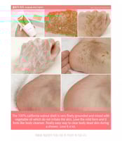 مقشر الجسم ريري اول كيل المنعش - 150 جرام