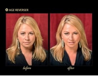 مشبك شد الوجه الخفي ايدج ريفيرزر شريط لشد العينين...