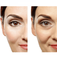 ام اسام كريم العين ريسفيراترول بريميوم أوجينكريم -...