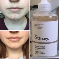 تونر اوردنري حمض الجليكوليك اسيد تونيك 240 مل