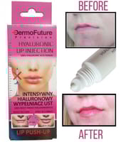 ديرموفيوتشر مكبر الشفاه بحمض الهيالورونيك 12مل