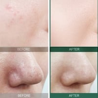 سوم باي مي كريم ميراكل 30 يوم المعزز بالأحماض - 60...