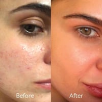 كودالي فينو بيرفكت سيروم تفتيح البشرة - 30 مل