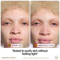 منظف ​​زيت الشوفان والفطر والفيتامينات والدهون 30...