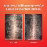 هيرتامين فيتامين للنمو الشعر - 30 كبسولة