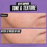 كيلز سيروم ريتينول للبشرة 4 مل ميني