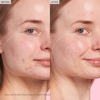 جلو ريسيبي سيروم بلاك بيري ريتينول 5 مل ميني