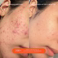 تاور 28 بخاخ اس او اس للحماية اليومية للوجه 120 مل