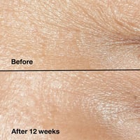 كلينيك كريم تصحيح التجاعيد 5 مل حجم ميني