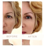 لصقات جفن العين صمول - 90 قطعة